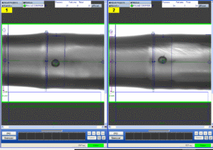 DRTS Dripper Vision System